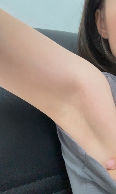 관리 후 사진